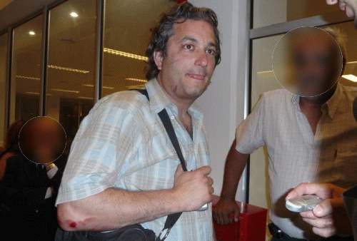 El periodista de InfoBAN golpeado por fotografiar a los agresores 