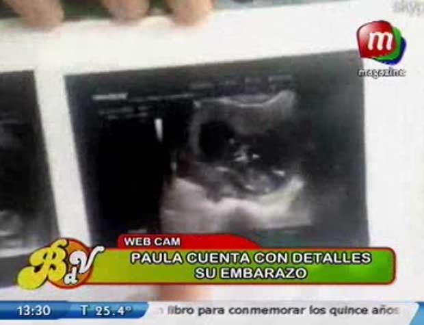 Paula Cháves mostró la primera ecografía de su bebé y aseguró que la celulitis no opacará su embarazo Paula Cháves mostró la primera ecografía de su bebé y aseguró que la celulitis no opacará su embarazo