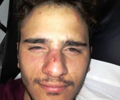 Denuncian brutal golpiza a un joven por su condición sexual Denuncian brutal golpiza a un joven por su condición sexual