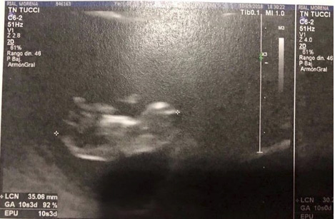Morena Rial confirmó su embarazo y mostró una ecografía