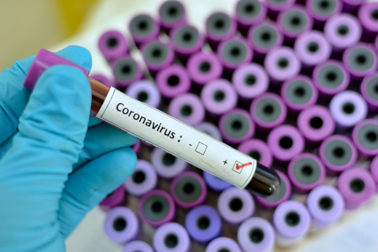 Alerta en Córdoba: un médico que tenía coronavirus pero sin síntomas contagió a 27 personas en un geriátrico